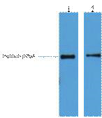 HIS Tag Antibody